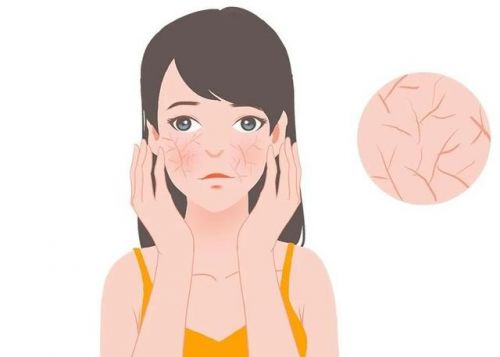 护霜：修护敏感肌肤重塑健康屏障AG旗舰厅首页第二代薇诺娜特(图4)