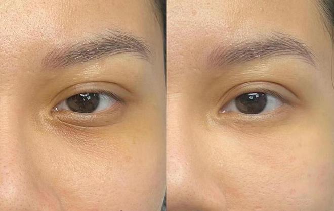 ？卸掉班味热门抗初老眼霜实测合集AG旗舰厅网什么眼霜去皱效果好(图8)